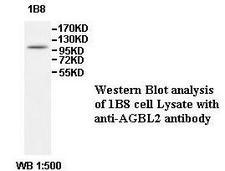 AGBL2 / CCP2 Antibody
