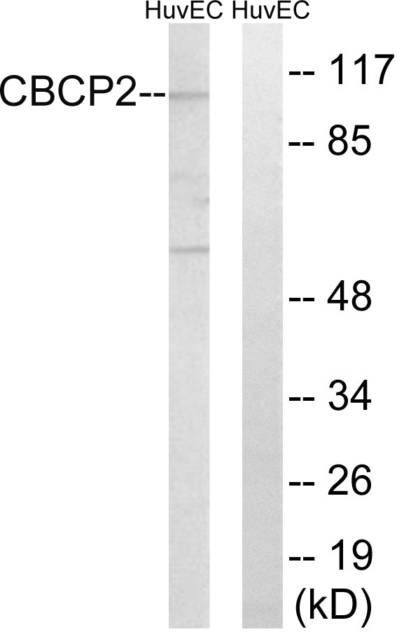 AGBL2 / CCP2 Antibody - Western blot analysis of lysates from HUVEC cells, using CBCP2 Antibody. The lane on the right is blocked with the synthesized peptide.