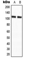 AGBL2 / CCP2 Antibody - Western blot analysis of CCP2 expression in HepG2 (A); NIH3T3 (B) whole cell lysates.
