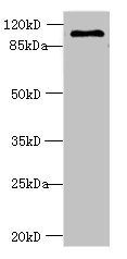 AGBL2 / CCP2 Antibody - Western blot All lanes: AGBL2 antibody at 8µg/ml + Mouse brain tissue Secondary Goat polyclonal to rabbit IgG at 1/10000 dilution Predicted band size: 105, 50, 33 kDa Observed band size: 105 kDa