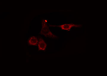 AGBL2 / CCP2 Antibody - Staining HuvEc cells by IF/ICC. The samples were fixed with PFA and permeabilized in 0.1% Triton X-100, then blocked in 10% serum for 45 min at 25°C. The primary antibody was diluted at 1:200 and incubated with the sample for 1 hour at 37°C. An Alexa Fluor 594 conjugated goat anti-rabbit IgG (H+L) antibody, diluted at 1/600, was used as secondary antibody.