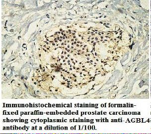 AGBL4 Antibody