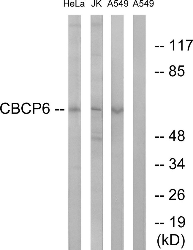 AGBL4 Antibody - Western blot analysis of lysates from A549, HeLa, and Jurkat cells, using AGBL4 Antibody. The lane on the right is blocked with the synthesized peptide.