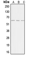 AGBL4 Antibody - Western blot analysis of AGBL4 expression in HepG2 (A); Jurkat (B); HeLa (C) whole cell lysates.