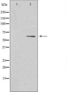 AGBL4 Antibody - Western blot analysis of extracts of HeLa cells using CBCP6 antibody. The lane on the left is treated with the antigen-specific peptide.