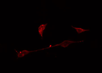 AGBL4 Antibody - Staining A549 cells by IF/ICC. The samples were fixed with PFA and permeabilized in 0.1% Triton X-100, then blocked in 10% serum for 45 min at 25°C. The primary antibody was diluted at 1:200 and incubated with the sample for 1 hour at 37°C. An Alexa Fluor 594 conjugated goat anti-rabbit IgG (H+L) antibody, diluted at 1/600, was used as secondary antibody.