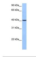 AGBL5 Antibody - Fetal liver cell lysate. Antibody concentration: 1.0 ug/ml. Gel concentration: 12%.  This image was taken for the unconjugated form of this product. Other forms have not been tested.
