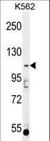 AGBL5 Antibody - AGBL5 Antibody western blot of K562 cell line lysates (35 ug/lane). The AGBL5 antibody detected the AGBL5 protein (arrow).