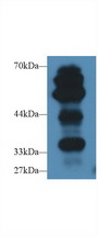 AGER / RAGE Antibody - Western Blot; Sample: Rat Lung lysate; Primary Ab: 2µg/ml Rabbit Anti-Mouse AGER Antibody Second Ab: 0.2µg/mL HRP-Linked Caprine Anti-Rabbit IgG Polyclonal Antibody