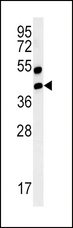 AGER / RAGE Antibody - Western blot of AGER-K44 in mouse lung tissue lysates (35 ug/lane). AGER (arrow) was detected using the purified antibody.