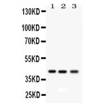 AGER / RAGE Antibody - RAGE antibody Western blot. All lanes: Anti RAGE at 0.5 ug/ml. Lane 1: Rat Lung Tissue Lysate at 50 ug. Lane 2: RH35 Whole Cell Lysate at 40 ug. Lane 3: HELA Whole Cell Lysate at 40 ug. Predicted band size: 43 kD. Observed band size: 43 kD.