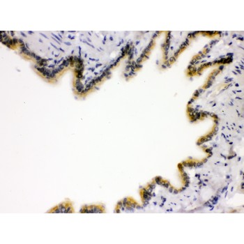 AGER / RAGE Antibody - RAGE antibody IHC-paraffin. IHC(P): Rat Lung Tissue.