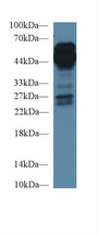 AGER / RAGE Antibody - Western Blot; Sample: Human Lung lysate; Primary Ab: 1µg/ml Rabbit Anti-Human AGER Antibody Second Ab: 0.2µg/mL HRP-Linked Caprine Anti-Rabbit IgG Polyclonal Antibody