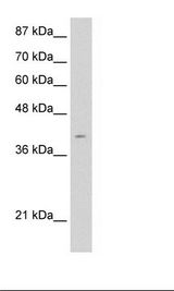 AGER / RAGE Antibody - Jurkat Cell Lysate.  This image was taken for the unconjugated form of this product. Other forms have not been tested.