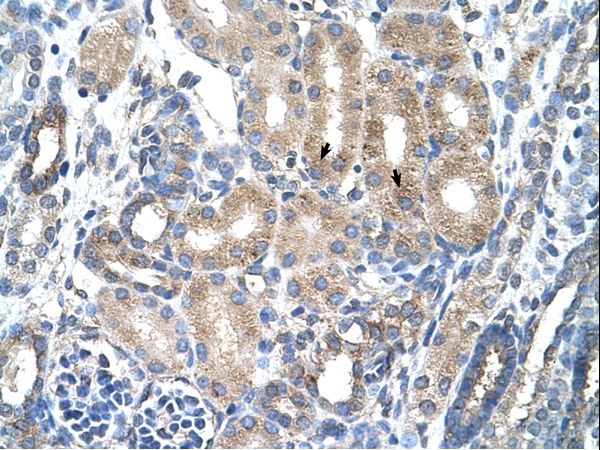AGER / RAGE Antibody - AGER antibody ARP41643_T100-NP_751947-AGER(advanced glycosylation end product-specific receptor) Antibody was used in IHC to stain formalin-fixed, paraffin-embedded human kidney.  This image was taken for the unconjugated form of this product. Other forms have not been tested.