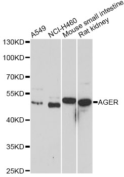 AGER / RAGE Antibody - Western blot analysis of extracts of various cell lines, using AGER antibody at 1:1000 dilution. The secondary antibody used was an HRP Goat Anti-Rabbit IgG (H+L) at 1:10000 dilution. Lysates were loaded 25ug per lane and 3% nonfat dry milk in TBST was used for blocking. An ECL Kit was used for detection and the exposure time was 90s.