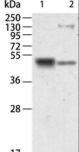 AGER / RAGE Antibody - Western blot analysis of Human kidney and mouse brain tissue, using AGER Polyclonal Antibody at dilution of 1:750.