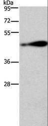 AGER / RAGE Antibody - Western blot analysis of 231 cell, using AGER Polyclonal Antibody at dilution of 1:750.