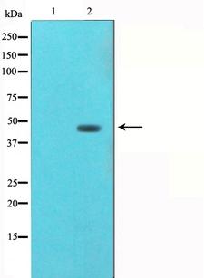 AGER / RAGE Antibody - Western blot analysis of AGER (RAGE) expression in HuvEc whole cells lysate. The lane on the left is treated with the antigen-specific peptide.