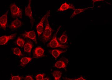 AGER / RAGE Antibody - Staining HepG2 cells by IF/ICC. The samples were fixed with PFA and permeabilized in 0.1% Triton X-100, then blocked in 10% serum for 45 min at 25°C. The primary antibody was diluted at 1:200 and incubated with the sample for 1 hour at 37°C. An Alexa Fluor 594 conjugated goat anti-rabbit IgG (H+L) Ab, diluted at 1/600, was used as the secondary antibody.