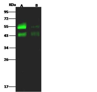 AGER / RAGE Antibody - Anti-RAGE rabbit polyclonal antibody at 1:500 dilution. Lane A: Mouse lung Tissue lysate. Lane B: Rat lung Tissue lysate. Lysates/proteins at 30 ug per lane. Secondary: Goat Anti-Rabbit IgG H&L (Dylight 800) at 1/10000 dilution. Developed using the Odyssey technique. Performed under reducing conditions. Predicted band size: 42 kDa. Observed band size: 43 kDa. (We are unsure as to the identity of these extra bands.)