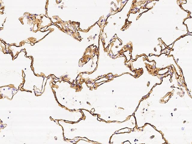 AGER / RAGE Antibody - Immunochemical staining of human AGER in human lung with rabbit polyclonal antibody at 1:1000 dilution, formalin-fixed paraffin embedded sections.