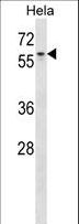 AGFG1 Antibody - AGFG1 Antibody western blot of HeLa cell line lysates (35 ug/lane). The AGFG1 antibody detected the AGFG1 protein (arrow).