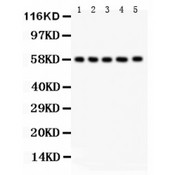 AGFG1 Antibody - AGFG1 antibody Western blot. All lanes: Anti AGFG1 at 0.5 ug/ml. Lane 1: Rat Testis Tissue Lysate at 50 ug. Lane 2: Rat Liver Tissue Lysate at 50 ug. Lane 3: Human Placenta Tissue Lysate at 50 ug. Lane 4: MCF-7 Whole Cell Lysate at 40 ug. Lane 5: HELA Whole Cell Lysate at 40 ug. Predicted band size: 58 kD. Observed band size: 58 kD.