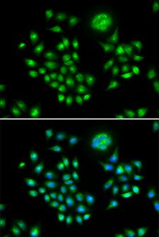 AGFG1 Antibody - Immunofluorescence analysis of HeLa cells.