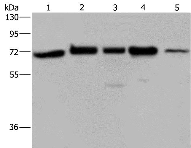 AGFG1 Antibody - Western blot analysis of A172, HeLa and 293T cell, K562 cell and human testis tissue, using AGFG1 Polyclonal Antibody at dilution of 1:727.