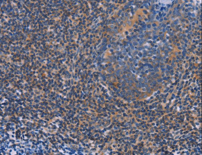 AGFG1 Antibody - Immunohistochemistry of paraffin-embedded Human tonsil using AGFG1 Polyclonal Antibody at dilution of 1:60.
