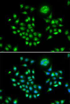 AGFG1 Antibody - Immunofluorescence analysis of HeLa cells using AGFG1 antibody. Blue: DAPI for nuclear staining.