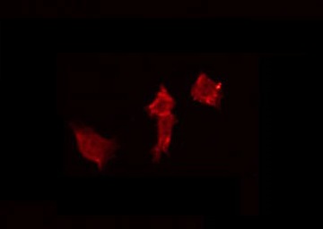 AGFG2 Antibody - Staining MCF-7 cells by IF/ICC. The samples were fixed with PFA and permeabilized in 0.1% Triton X-100, then blocked in 10% serum for 45 min at 25°C. The primary antibody was diluted at 1:200 and incubated with the sample for 1 hour at 37°C. An Alexa Fluor 594 conjugated goat anti-rabbit IgG (H+L) Ab, diluted at 1/600, was used as the secondary antibody.