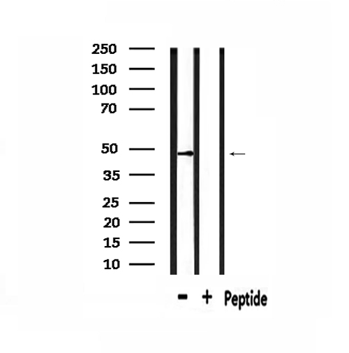 AGFG2 Antibody - Western blot analysis of extracts of mouse kidney using Rabr antibody.