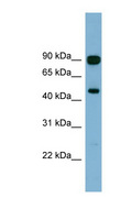 AGK Antibody - AGK antibody Western blot of Fetal Brain lysate. This image was taken for the unconjugated form of this product. Other forms have not been tested.