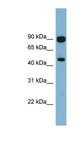AGK Antibody - AGK antibody Western blot of Fetal Brain lysate. This image was taken for the unconjugated form of this product. Other forms have not been tested.