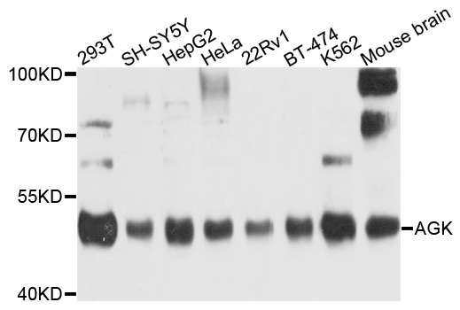 AGK Antibody - Western blot analysis of extracts of various cells.