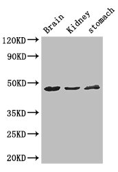 AGK Antibody - Positive WB detected in:Mouse brain tissue,Mouse kidney tissue,Mouse stomach tissue;All lanes: AGK antibody at 3ug/ml;Secondary;Goat polyclonal to rabbit IgG at 1/50000 dilution;Predicted band size: 48,8 kDa;Observed band size: 48 kDa;