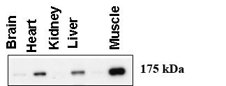 AGL Antibody - Western blot using anti-AGL antibody at 1:1000 dilution. A total of 20 ug of lysates was loaded for each tissue. Data courtesy of Dr. Alan Cheng, Department of Internal Medicine, Life Sciences Institute, University of Michigan Medical Center, Ann Arbor, Michigan.