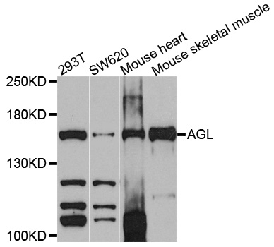 AGL Antibody - Western blot analysis of extracts of various cell lines, using AGL antibody at 1:1000 dilution. The secondary antibody used was an HRP Goat Anti-Rabbit IgG (H+L) at 1:10000 dilution. Lysates were loaded 25ug per lane and 3% nonfat dry milk in TBST was used for blocking. An ECL Kit was used for detection and the exposure time was 90s.