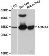 AGMAT Antibody - Western blot analysis of extracts of various cell lines, using AGMAT antibody at 1:1000 dilution. The secondary antibody used was an HRP Goat Anti-Rabbit IgG (H+L) at 1:10000 dilution. Lysates were loaded 25ug per lane and 3% nonfat dry milk in TBST was used for blocking. An ECL Kit was used for detection and the exposure time was 1s.