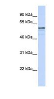 AGMO / TMEM195 Antibody - AGMO / TMEM195 antibody Western blot of MCF7 cell lysate. This image was taken for the unconjugated form of this product. Other forms have not been tested.