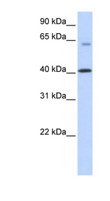 AGMO / TMEM195 Antibody - AGMO / TMEM195 antibody Western blot of Transfected 293T cell lysate. This image was taken for the unconjugated form of this product. Other forms have not been tested.