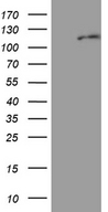 AGO1 / EIF2C Antibody - HEK293T cells were transfected with the pCMV6-ENTRY control. (Left lane) or pCMV6-ENTRY EIF2C1. (Right lane) cDNA for 48 hrs and lysed. Equivalent amounts of cell lysates. (5 ug per lane) were separated by SDS-PAGE and immunoblotted with anti-EIF2C1. (1:2000)
