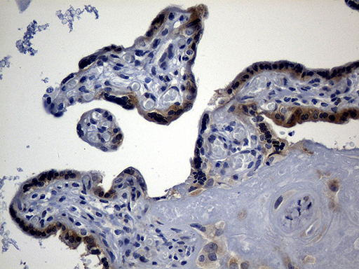 AGO1 / EIF2C Antibody - Immunohistochemical staining of paraffin-embedded Human placenta tissue within the normal limits using anti-EIF2C1 mouse monoclonal antibody. (Heat-induced epitope retrieval by 1mM EDTA in 10mM Tris buffer. (pH8.5) at 120 oC for 3 min. (1:150)