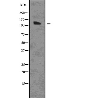 AGO1 / EIF2C Antibody - Western blot analysis of AGO1 using HuvEc whole cells lysates