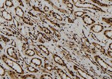 AGO1 / EIF2C Antibody - 1:100 staining human kidney tissue by IHC-P. The sample was formaldehyde fixed and a heat mediated antigen retrieval step in citrate buffer was performed. The sample was then blocked and incubated with the antibody for 1.5 hours at 22°C. An HRP conjugated goat anti-rabbit antibody was used as the secondary.