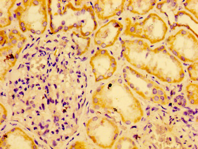 AGO2 / EIF2C2 Antibody - Immunohistochemistry of paraffin-embedded human kidney tissue using AGO2 Antibody at dilution of 1:100