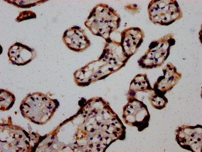 AGO2 / EIF2C2 Antibody - IHC image of AGO2 Antibody diluted at 1:1200 and staining in paraffin-embedded human placenta tissue performed on a Leica BondTM system. After dewaxing and hydration, antigen retrieval was mediated by high pressure in a citrate buffer (pH 6.0). Section was blocked with 10% normal goat serum 30min at RT. Then primary antibody (1% BSA) was incubated at 4°C overnight. The primary is detected by a biotinylated secondary antibody and visualized using an HRP conjugated SP system.