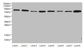AGO2 / EIF2C2 Antibody - Western blot All lanes: Protein argonaute-2 antibody at 2µg/ml Lane 1: A549 whole cell lysate Lane 2: Jurkats whole cell lysate Lane 3: MCF-7 whole cell lysate Lane 4: HepG2 whole cell lysate Lane 5: Raw264.7 whole cell lysate Lane 6: K562 whole cell lysate Lane 7: Mouse liver tissue Lane 8: Mouse kidney tissue Secondary Goat polyclonal to rabbit IgG at 1/10000 dilution Predicted band size: 98, 94 kDa Observed band size: 94 kDa